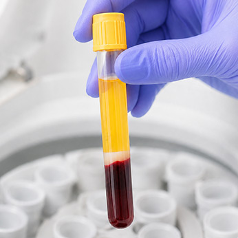 Stem cell extraction