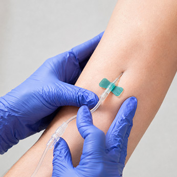 Intravenous stem cell injection