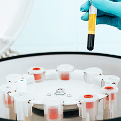 Improves wrinkles & sagging, and more Various functions - Anti-Aging Stem Cell Procedure